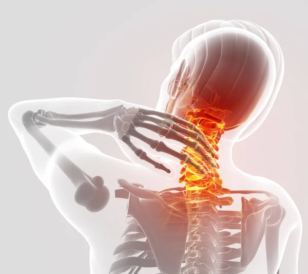 3d Illustration of men Feeling the Neck Pain — Stock Photo, Image