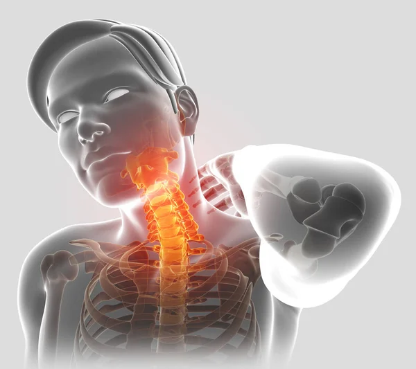 3d Illustration of men Feeling the Neck Pain — Stock Photo, Image