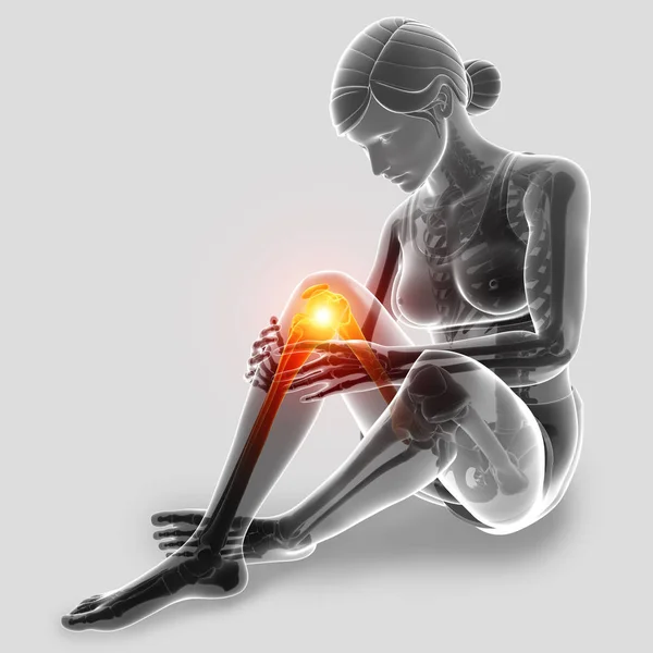 Ilustración 3d de las mujeres sintiendo dolor de rodilla — Foto de Stock