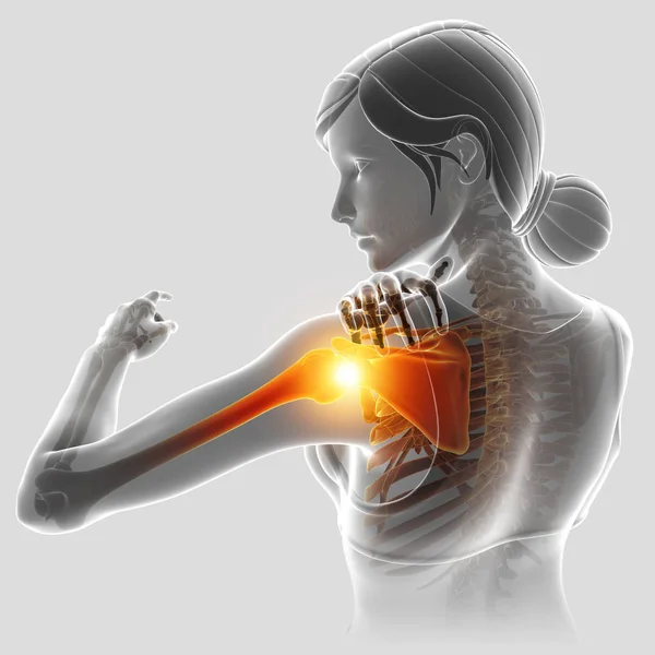 여성 어깨 통증을 느낌의 3d 그림 — 스톡 사진