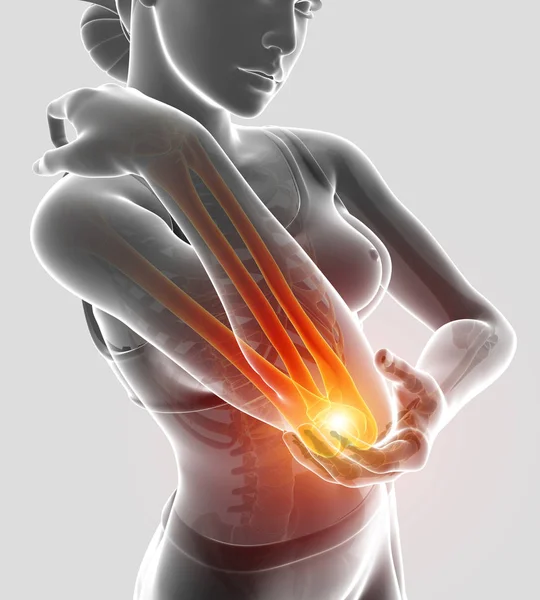 3d Illustration of Women Feeling Elbow pain — Stock Photo, Image