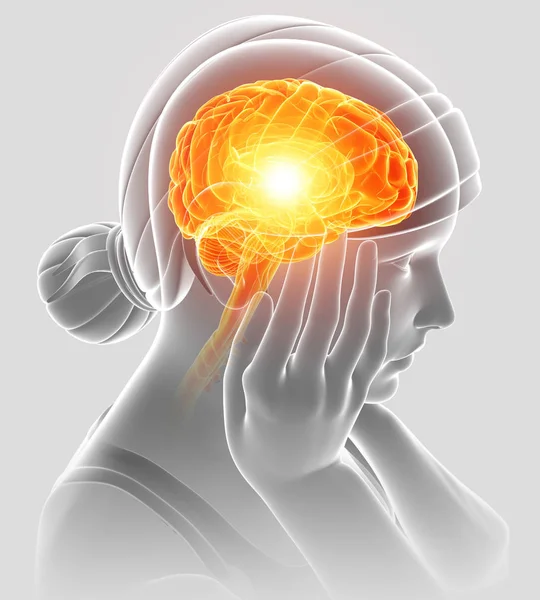 3D Illustration von Frauen, die Kopfschmerzen empfinden — Stockfoto
