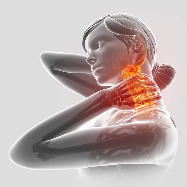 여성 목 통증을 느낌의 3d 그림 — 스톡 사진
