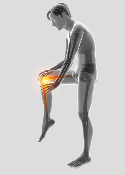 3d Illustration of Male feeling Knee pain