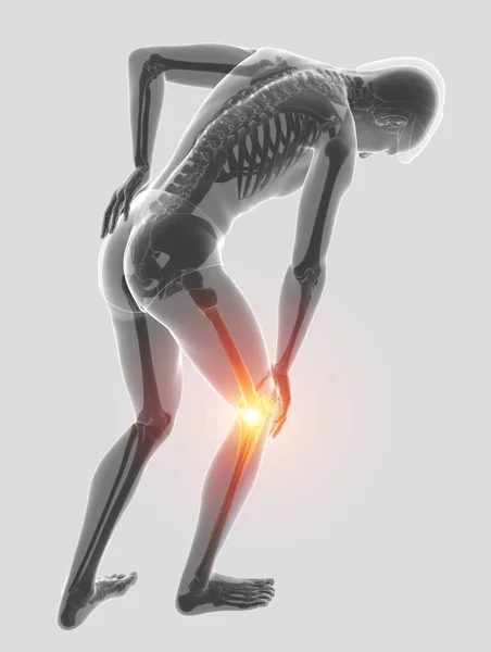 3D Illustration of male Feeling the back pain — Stock Photo, Image