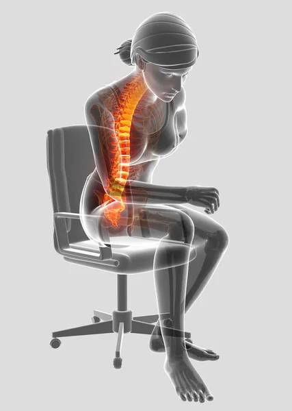 3D Illustration of Female Feeling the back pain