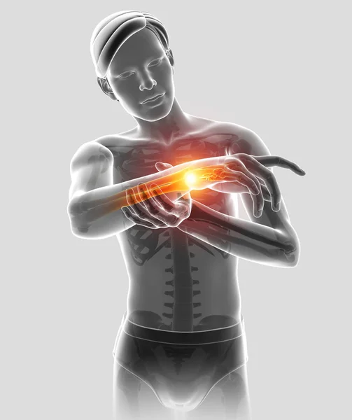 3D απεικόνιση του άνδρες συναίσθημα αγκώνα πόνο — Φωτογραφία Αρχείου