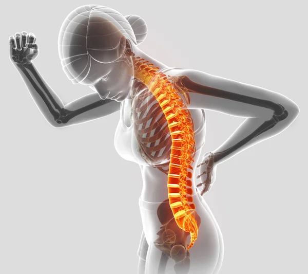 Трехмерное изображение женщины, испытывающей боль в спине — стоковое фото