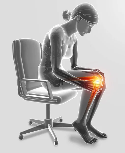 3d Иллюстрация женщин, испытывающих боль в коленях — стоковое фото