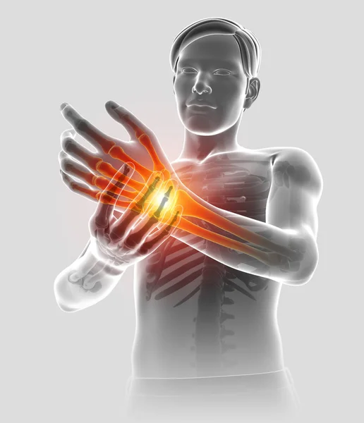 3D-s illusztráció a férfiak érzés könyök fájdalom — Stock Fotó