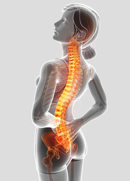 3D obrázek ženské pocit bolesti zad — Stock fotografie