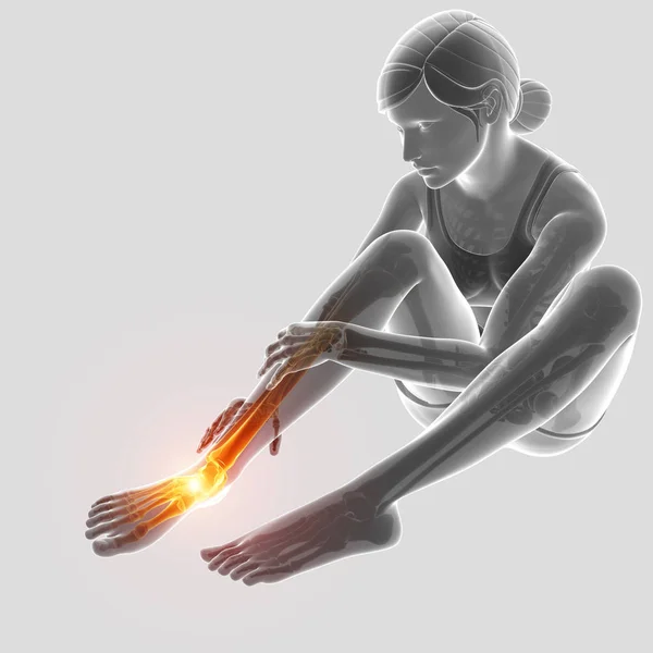 3D Illustration des weiblichen Fußes mit Knöchelschmerzen — Stockfoto