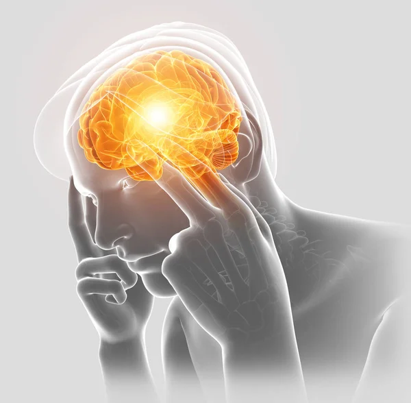 Ilustración 3d de dolor de cabeza masculino —  Fotos de Stock