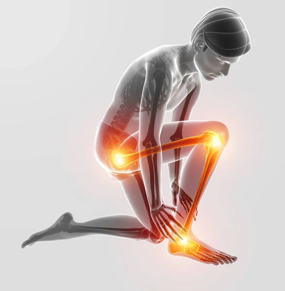 Ilustración 3d del dolor en la pierna — Foto de Stock