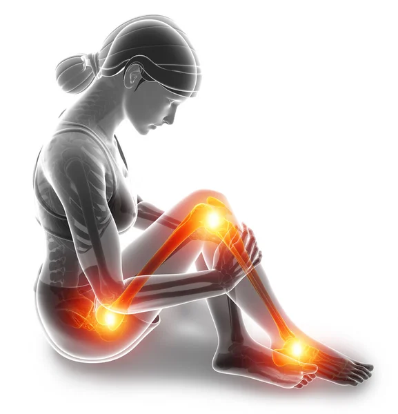 3D ilustracja ból w nodze — Zdjęcie stockowe