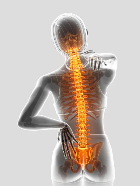 Ilustración 3D de la Mujer Sintiendo el dolor de espalda — Foto de Stock