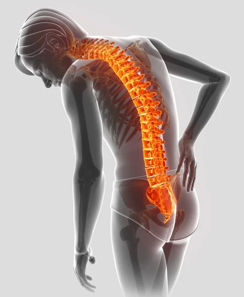 3D-Illustration des Mannes, der Rückenschmerzen spürt — Stockfoto