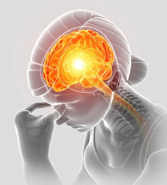3D απεικόνιση των γυναικών αισθάνεται πονοκέφαλο — Φωτογραφία Αρχείου
