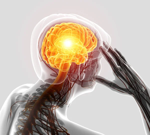 3D Illustration von männlichen Kopfschmerzen — Stockfoto