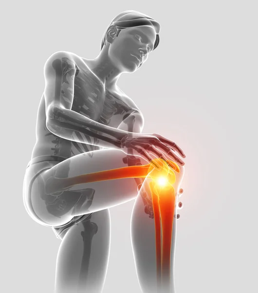 3D obrázek z mužské cítit bolest kolena — Stock fotografie