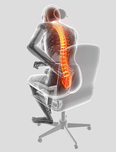 Ilustración 3D de la Mujer Sintiendo el dolor de espalda — Foto de Stock