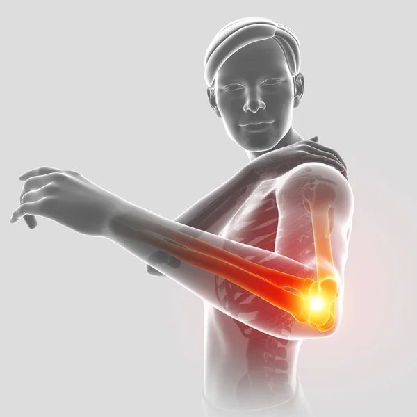 3d Illustration of Male Feeling Elbow pain — Stock Photo, Image