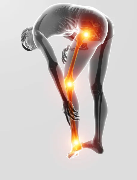 3d Illustration of Pain in leg — Stock Photo, Image