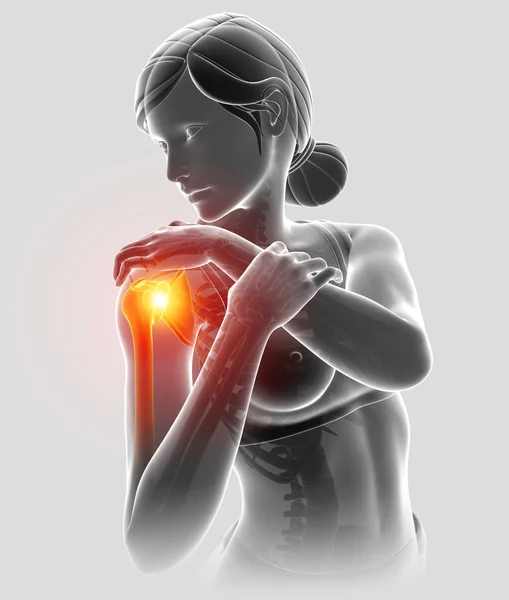 3d Illustration of Female Feeling the Shoulder Pain — Stock Photo, Image