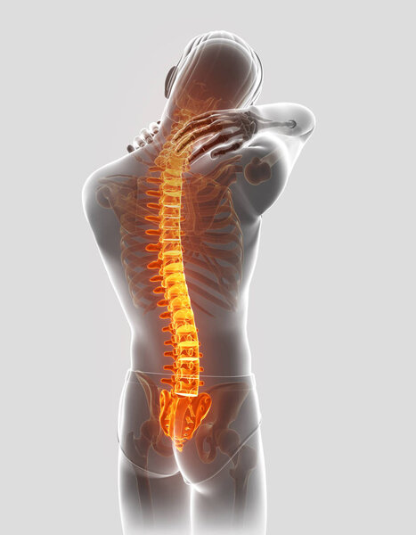 Трехмерное изображение мужчины, испытывающего боль в спине
