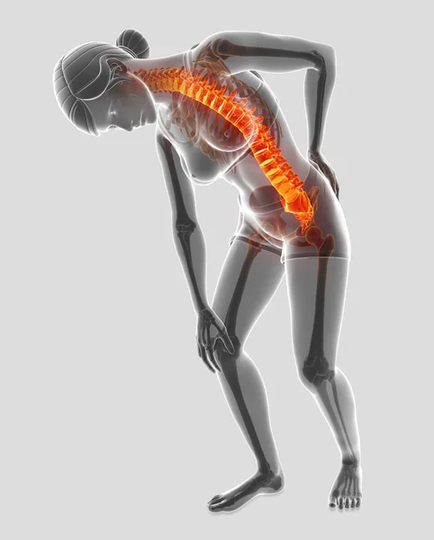 3D Illustration of Female Feeling the back pain — Stock Photo, Image