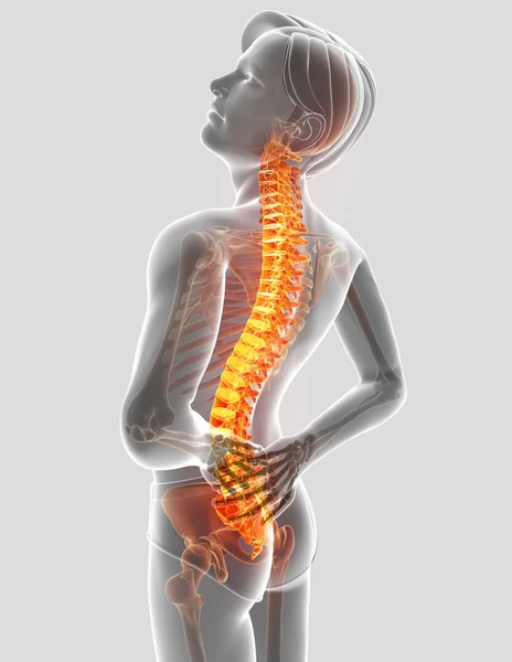 Трехмерное изображение мужчины, испытывающего боль в спине — стоковое фото