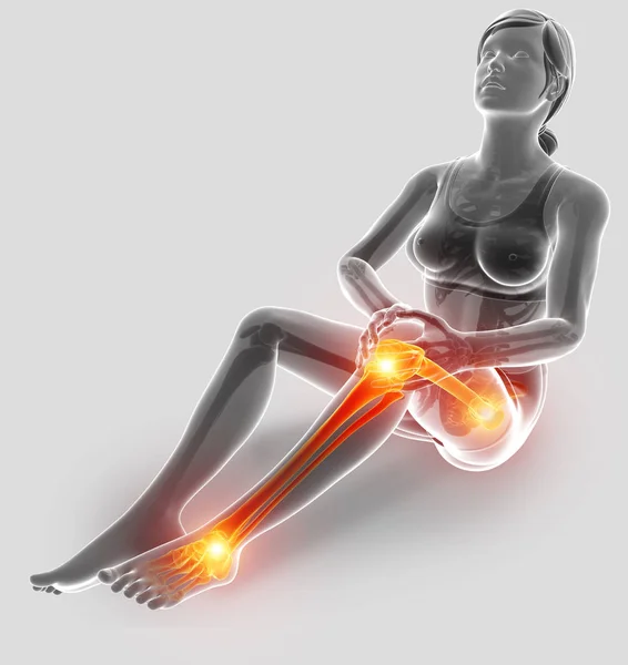 Illustration 3d de la douleur dans la jambe — Photo