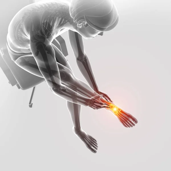 3D Illustration des männlichen Fußes mit Knöchelschmerzen — Stockfoto