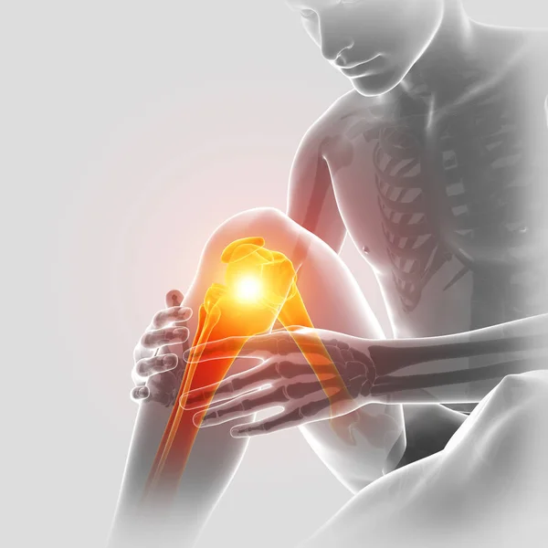 3d Illustration of Male feeling Knee pain — Stock Photo, Image