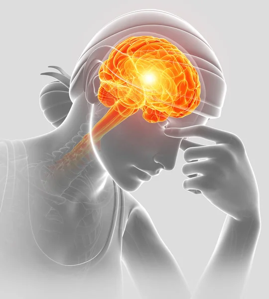 3d Illustrazione del mal di testa delle donne — Foto Stock