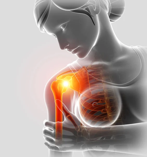 Ilustração 3d de sentir a dor no ombro feminino — Fotografia de Stock