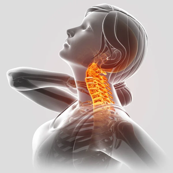Ilustración 3d de la mujer Sintiendo el dolor del cuello — Foto de Stock