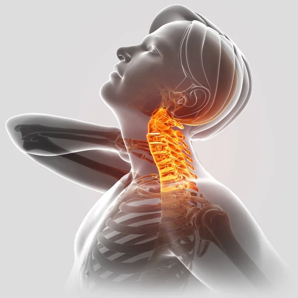 Ilustración 3d de hombres sintiendo el dolor del cuello — Foto de Stock