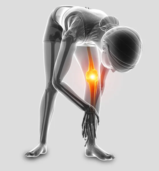 3d 图妇女感觉膝关节疼痛 — 图库照片