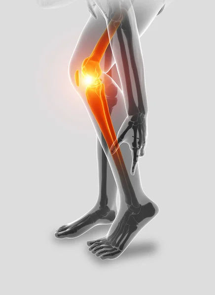 膝の痛みを感じる男性の 3 d 図 — ストック写真