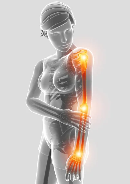 3d Illustration of Men Feeling Arm joint pain — Stock Photo, Image