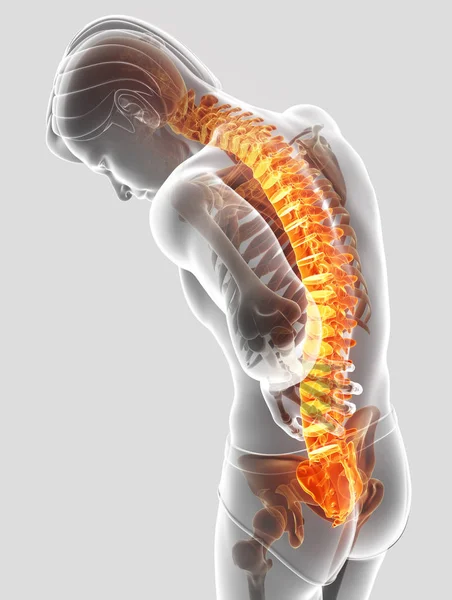 Ilustración 3D del varón Sintiendo el dolor de espalda — Foto de Stock