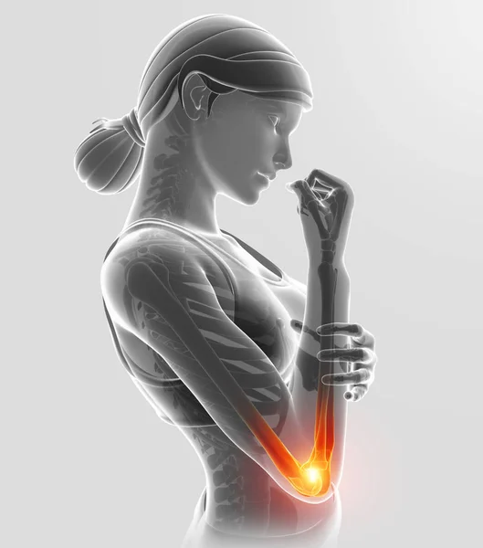 3D απεικόνιση των γυναικών συναίσθημα αγκώνα πόνος — Φωτογραφία Αρχείου