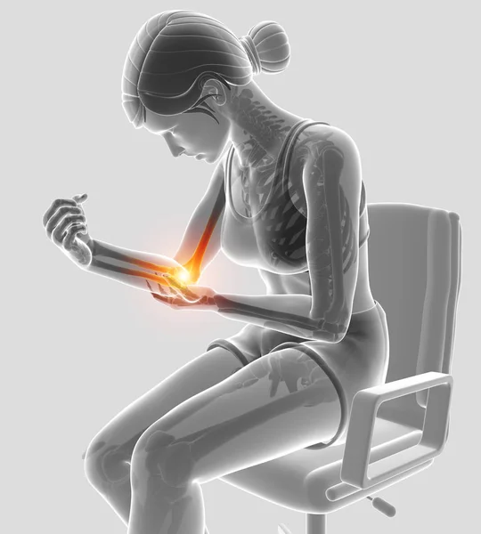 3d Illustration of Women Feeling Elbow pain — Stock Photo, Image