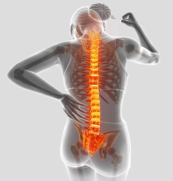 3D Illustration of Female Feeling the back pain — Stock Photo, Image