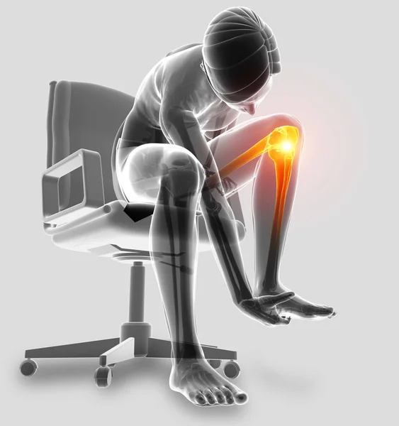 3D Illustration von männlichen Knieschmerzen — Stockfoto