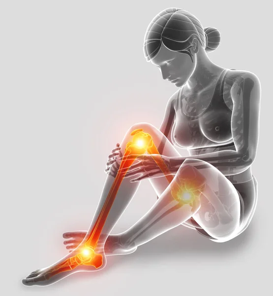 3D illustratie van pijn in been — Stockfoto
