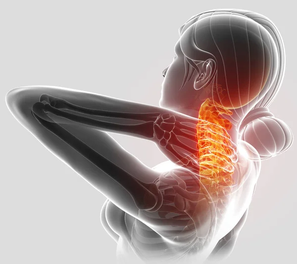 3d Illustration of female Feeling the Neck Pain