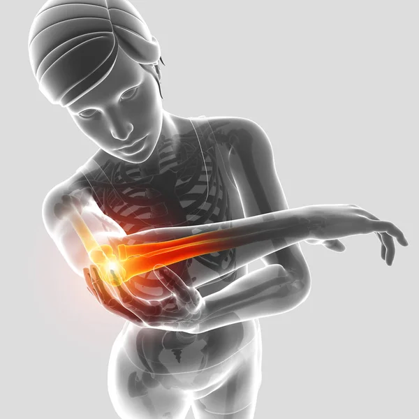 3d Illustration of Women Feeling Elbow pain — Stock Photo, Image