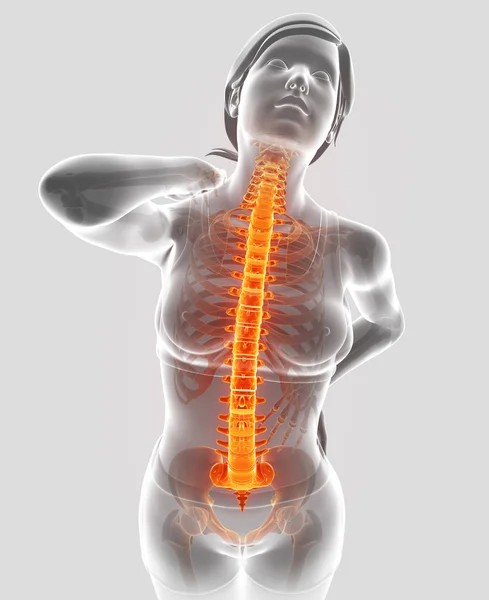 3D ілюстрація жінки Відчуття болю в спині — стокове фото